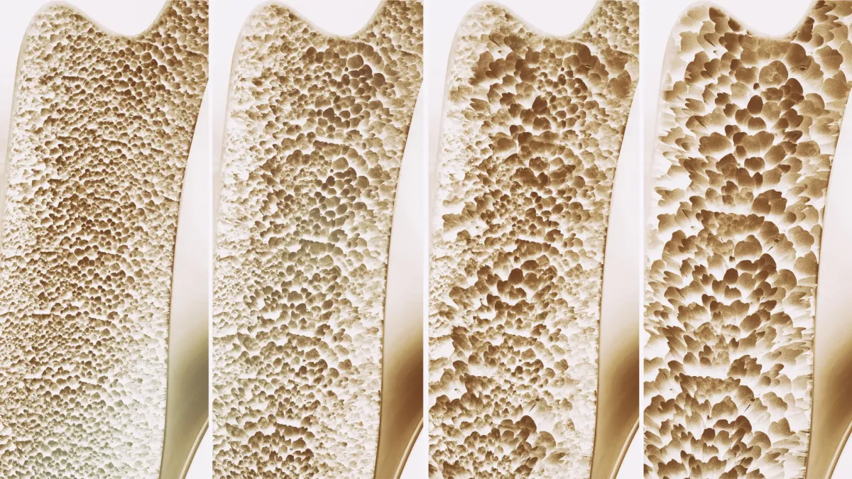 ScienceDaily
