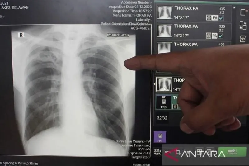 ANTARA News Jateng