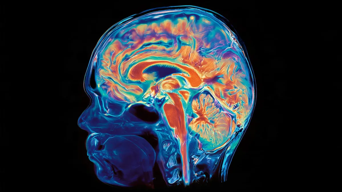 Photo: orbitindonesia.com Stanford researchers find human brain built from two distinct organs