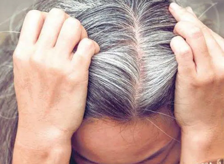 Klaim Bahan Dapur Bisa Jadi Obat Rambut Beruban, Ini yang Perlu Diketahui