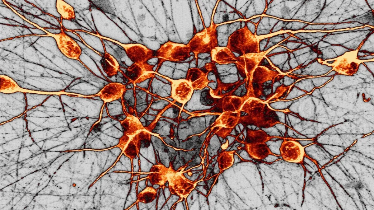 Dopamin Bukan Sekadar “Hormon Kebahagiaan”: Penjelasan Ilmiah di Balik Perannya di Otak