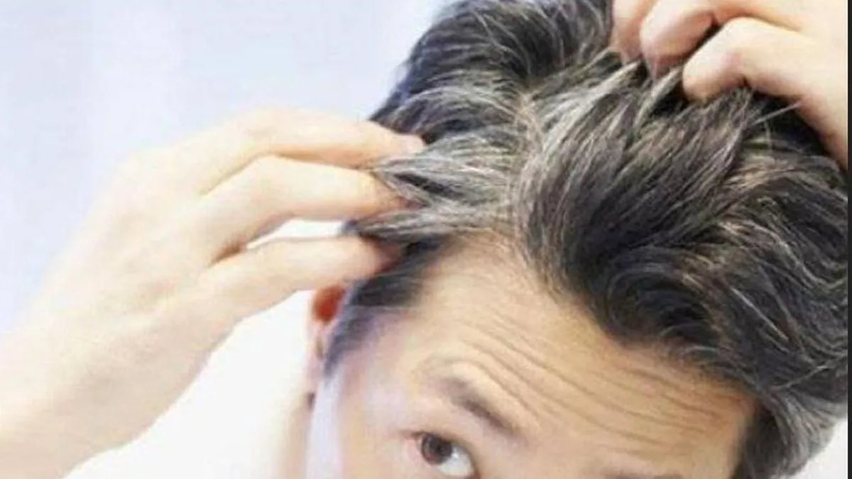 dr. Zaidul Akbar Sebut Rebusan Ketumbar Bisa Bantu Atasi Uban, Ini Cara Konsumsinya