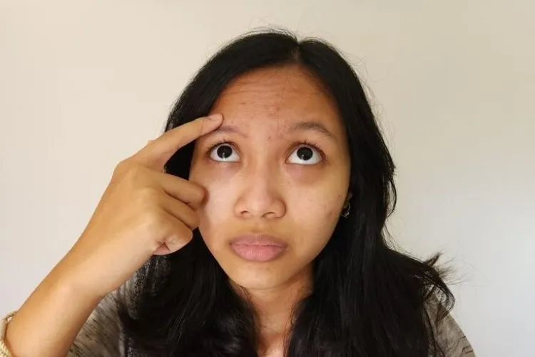 Cara Meracik Madu dan Garam untuk Mengatasi Beruntusan di Dahi