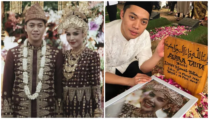 Kanker Kulit Renggut Nyawa Menantu Hatta Rajasa di Usia 27 Tahun