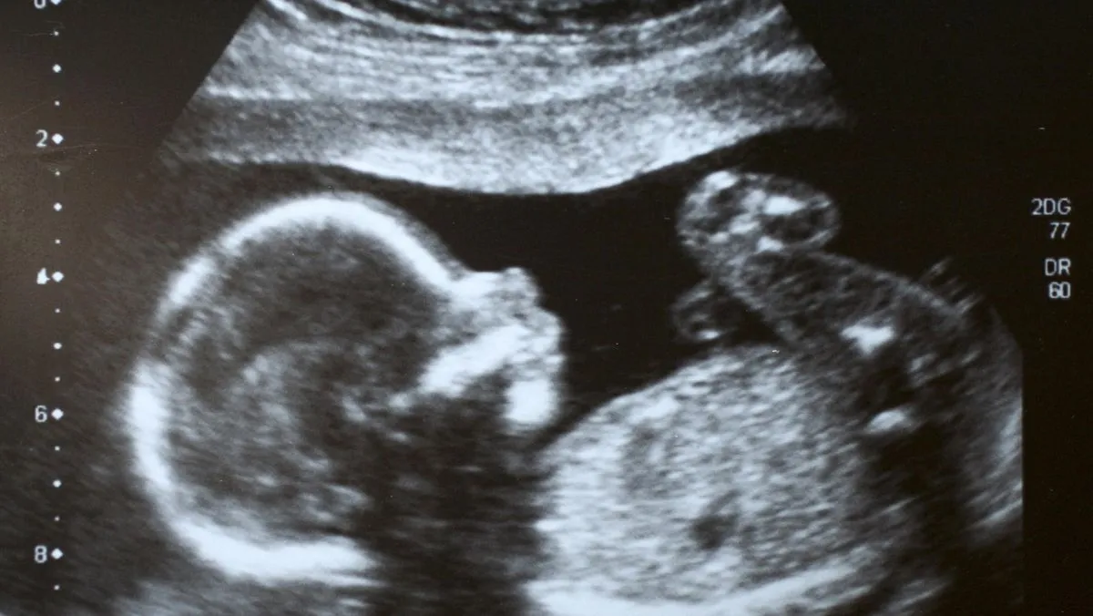 Perdebatan Etika Menguat soal Teknologi CRISPR untuk Mengedit Gen Embrio Manusia