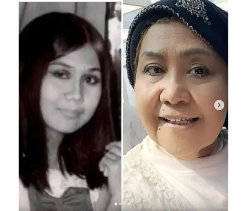 Penyanyi Senior Yetti Wijaya Dikabarkan Meninggal Dunia di Bandung