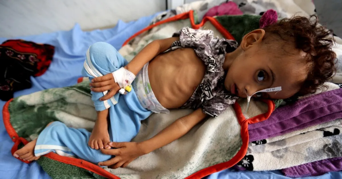 FAO: Lebih dari 52 Juta Orang Kekurangan Gizi di Timur Tengah dan Afrika Utara