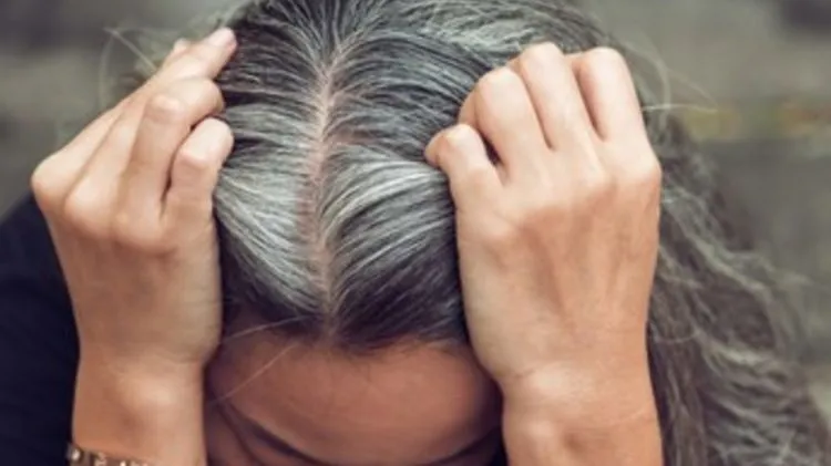 Uban dan Penyebabnya: Video TikTok Bagikan Masker Rambut dari Jintan Hitam, Aloe Vera, dan Minyak Kelapa