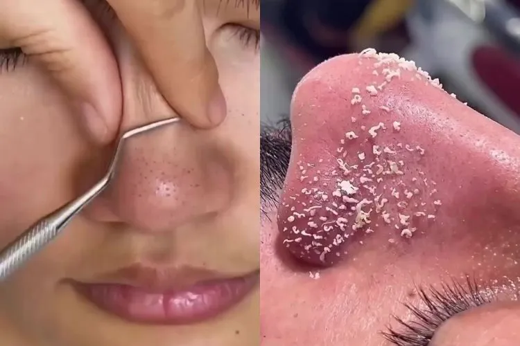 Masker Kopi, Gula, dan Yogurt Diklaim Bantu Bersihkan Pori-Pori dan Buat Wajah Lebih Halus