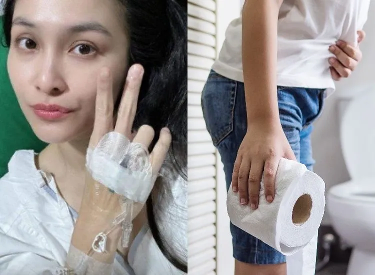 Sandra Dewi Disebut Jalani Operasi Ambeien Stadium 4, Ini Bahan Dapur yang Diklaim Bisa Membantu Meredakan Wasir