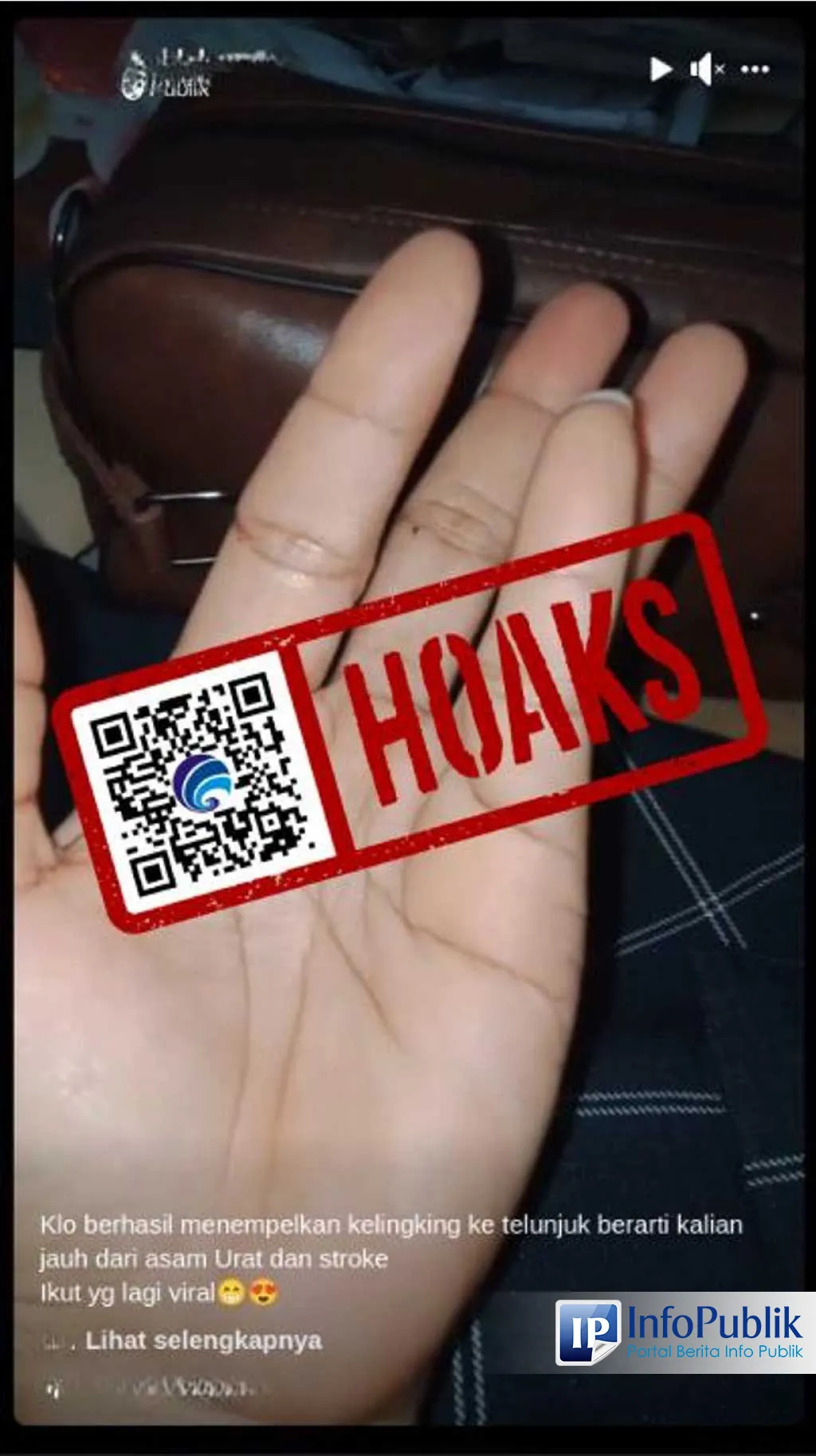 Klaim Deteksi Stroke Lewat Gerakan Jari di Facebook Disebut Menyesatkan