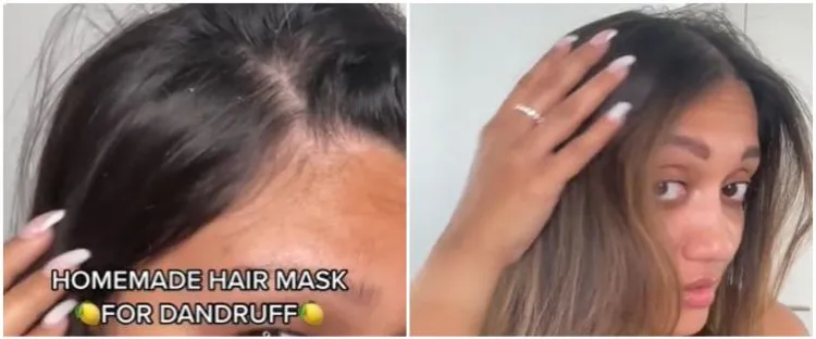Trik Masker Rambut dari Lemon dan Yoghurt untuk Mengurangi Ketombe Berkerak
