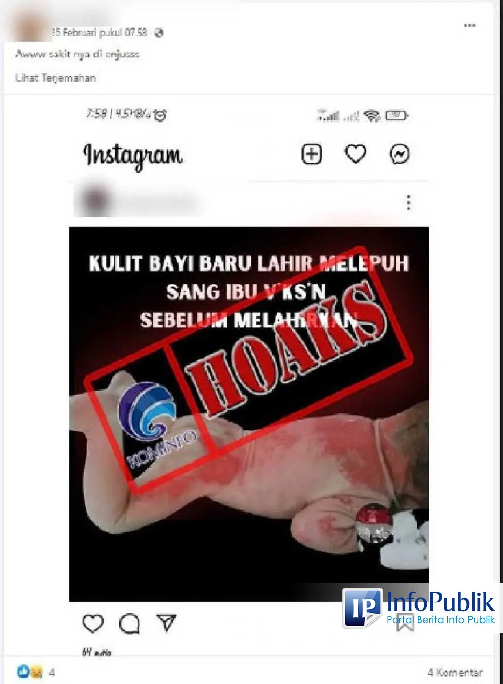 Cek Fakta: Tidak Ada Bukti Vaksin COVID-19 Saat Hamil Sebabkan Kulit Bayi Baru Lahir Melepuh