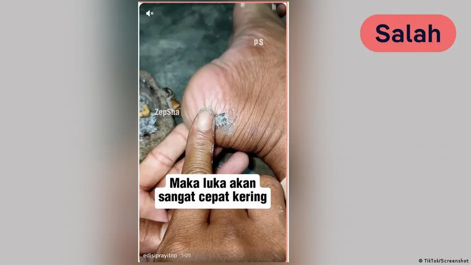 Cek Fakta: Klaim Abu Rokok Bisa Mengeringkan Luka Disebut Keliru