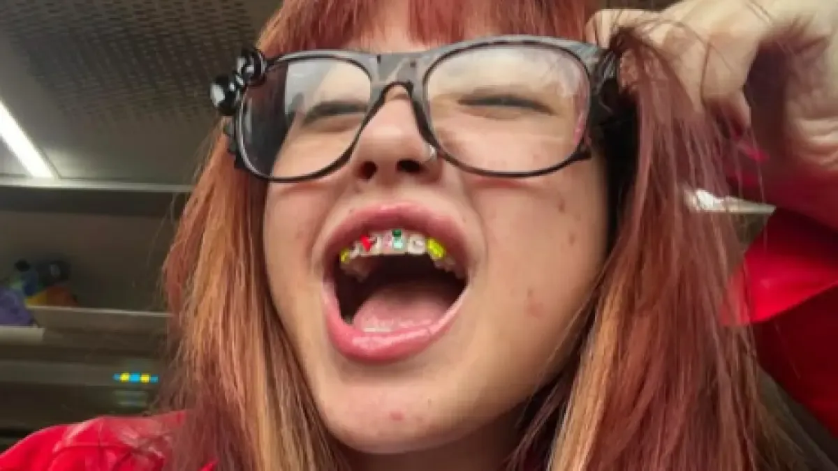 Tooth Gems ala Naykilla Jadi Sorotan, Tren Permata Gigi yang Kembali Viral