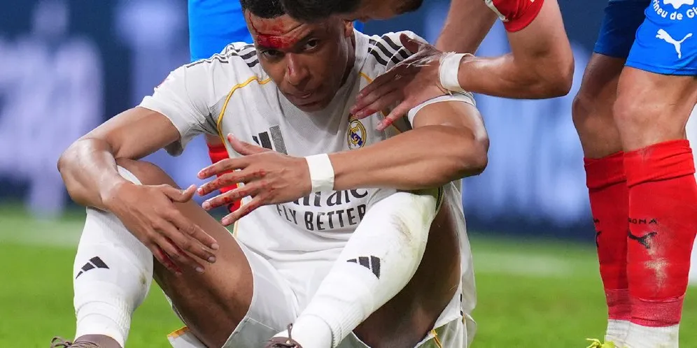 Insiden Mbappe Berdarah saat Lawan Girona, Real Madrid Siapkan Permintaan Rekaman Audio VAR