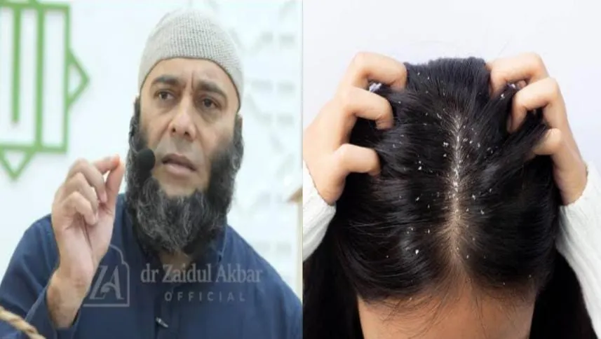 dr Zaidul Akbar Sebut Tiga Bahan Dapur untuk Membantu Atasi Ketombe, Rambut Rontok, dan Uban