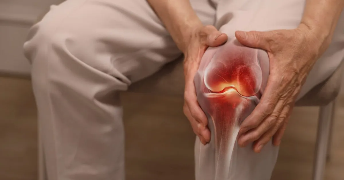 Studi: Mengubah Sudut Kaki Saat Berjalan Dapat Kurangi Nyeri Osteoartritis Lutut Tanpa Obat atau Operasi