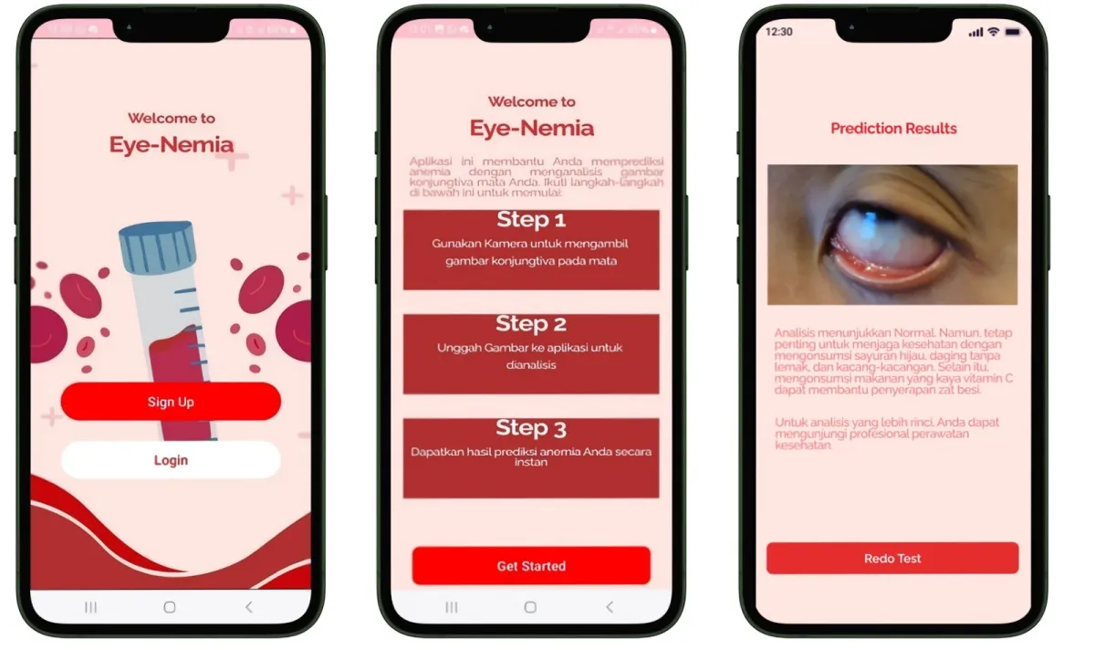Dosen Vokasi UMM Kembangkan Aplikasi Deteksi Anemia Mandiri Lewat Kamera Ponsel