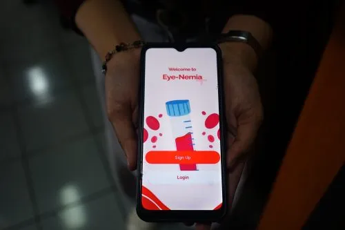 Dosen Vokasi UMM Kembangkan Aplikasi Eye-Nemia untuk Estimasi Anemia Lewat Foto Mata