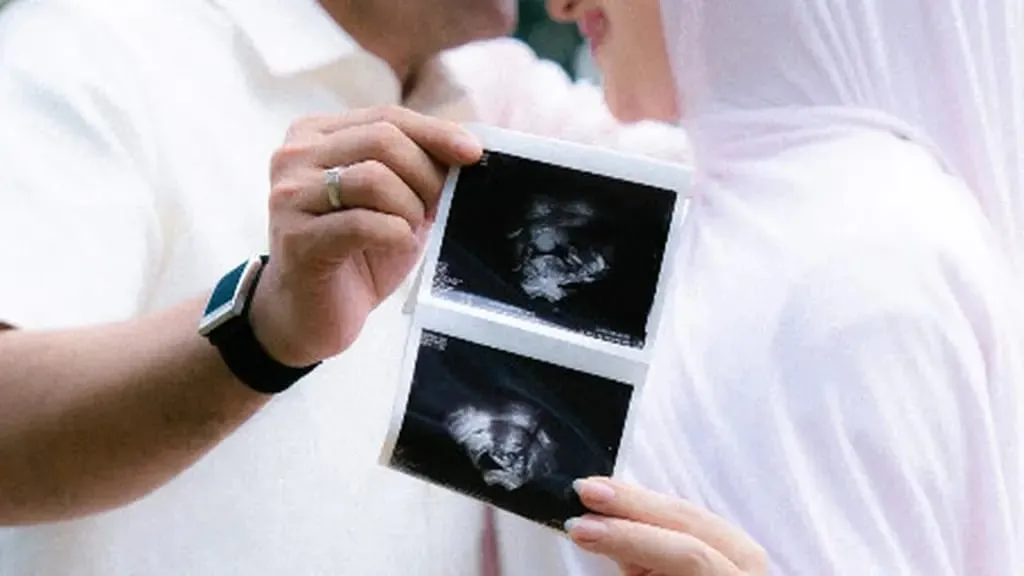 Irish Bella Umumkan Kehamilan Anak Pertama Lewat Unggahan Hasil USG