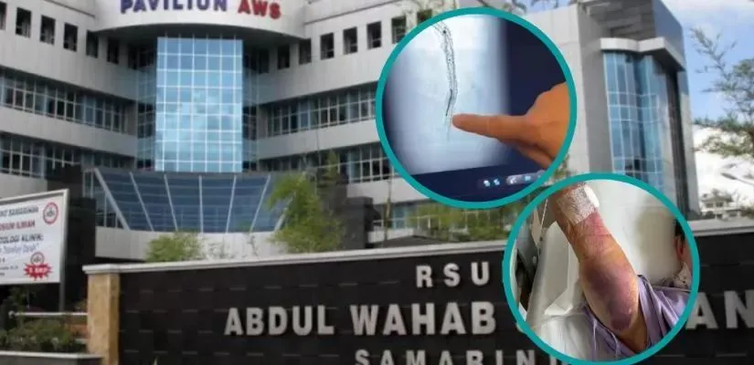 Dugaan Kawat Tertinggal di Arteri Jantung Pasien, Keluarga Layangkan Somasi ke RSUD AWS Samarinda