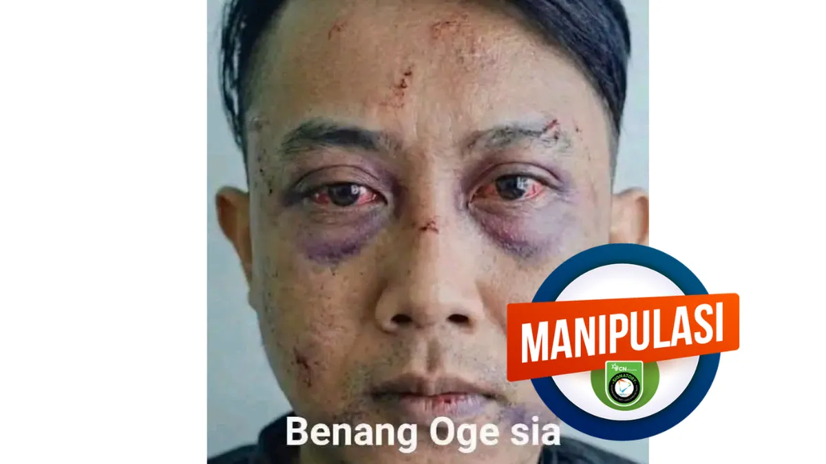 Foto Taufik Hidayat Babak Belur yang Beredar di Media Sosial Terindikasi Konten AI