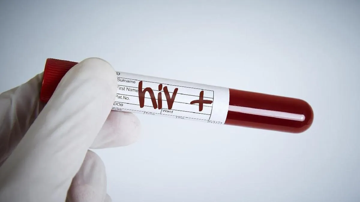 Obat HIV Rasa Stroberi untuk Anak-anak Disebut Segera Tersedia