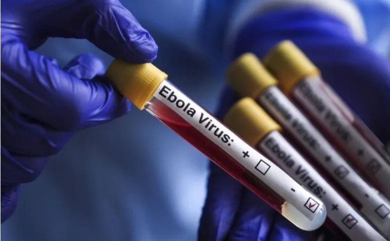 Virus Ebola.