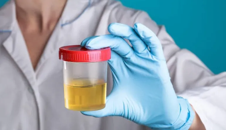 Tes urine.