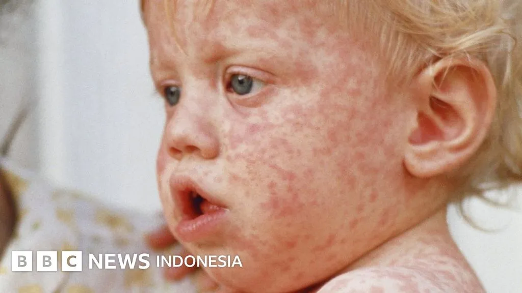 Rendahnya Kepercayaan Terhadap Vaksin Jadi Krisis Kesehatan Global